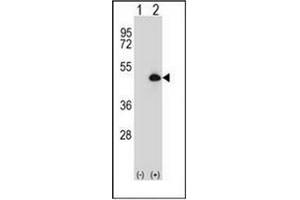 Image no. 2 for anti-Cytochrome P450, Family 20, Subfamily A, Polypeptide 1 (CYP20A1) (AA 228-258), (Middle Region) antibody (ABIN951777)
