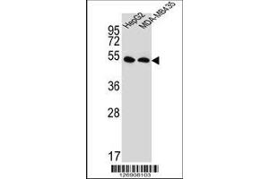anti-Solute Carrier Family 47, Member 1 (SLC47A1) (AA 492-519), (C-Term) antibody