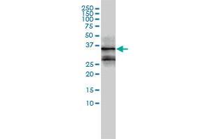 Image no. 5 for anti-FOS-Like Antigen 2 (FOSL2) (AA 1-122) antibody (ABIN560942)