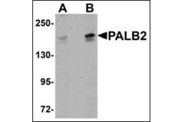 anti-Partner and Localizer of BRCA2 (PALB2) (C-Term) antibody
