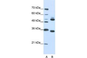 WB Suggested Anti-WDR6 Antibody Titration:  0.