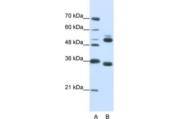 WDR6 antibody  (C-Term)