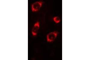 Image no. 1 for anti-Mitochondrial Ribosomal Protein L4 (MRPL4) (Internal Region) antibody (ABIN6258689)