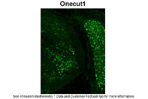 anti-One Cut Homeobox 1 (ONECUT1) (C-Term) antibody