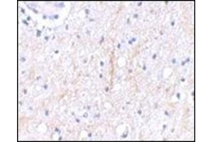 Image no. 1 for anti-Plexin Domain Containing 2 (PLXDC2) (C-Term) antibody (ABIN500517)