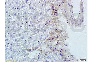 Image no. 2 for anti-Tumor Necrosis Factor (Ligand) Superfamily, Member 14 (TNFSF14) (AA 141-240) antibody (ABIN740625)