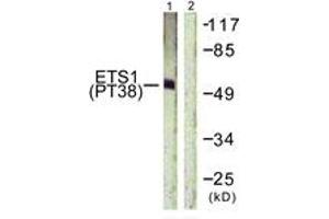 Western blot analysis of extracts from HeLa cells treated with Serum 20% 15', using ETS1 (Phospho-Thr38) Antibody.