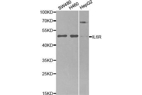 IL-6 Receptor Antikörper  (AA 20-320)