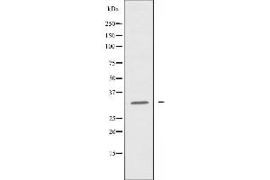 Image no. 2 for anti-Holocytochrome C Synthase (HCCS) (Internal Region) antibody (ABIN6257604)