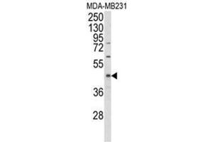 Image no. 1 for anti-Egl-9 Family Hypoxia Inducible Factor 2 (EGLN2) (Middle Region) antibody (ABIN453633)