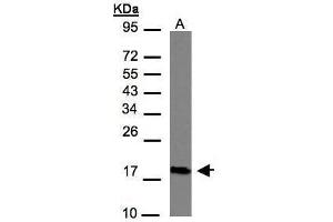 Image no. 3 for anti-CKLF-Like MARVEL Transmembrane Domain Containing 6 (CMTM6) (C-Term) antibody (ABIN2856604)