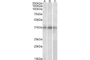 Image no. 1 for anti-PHD Finger Protein 11 (PHF11) (Internal Region) antibody (ABIN1686788)