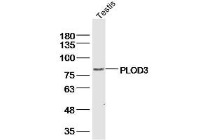 Image no. 1 for anti-Procollagen-Lysine, 2-Oxoglutarate 5-Dioxygenase 3 (PLOD3) (AA 551-650) antibody (ABIN5675341)