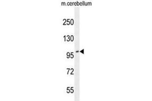 Image no. 1 for anti-ADAM Metallopeptidase with Thrombospondin Type 1 Motif, 10 (ADAMTS10) (AA 217-248), (N-Term) antibody (ABIN950271)