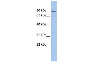Image no. 1 for anti-Nephronophthisis 1 (Juvenile) (NPHP1) antibody (ABIN634609)