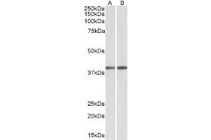 Image no. 4 for anti-Guanine Nucleotide Binding Protein (G Protein), Q Polypeptide (GNAQ) (AA 162-175) antibody (ABIN625823)