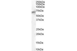 Image no. 1 for anti-Signal Transducing Adaptor Molecule (SH3 Domain and ITAM Motif) 2 (STAM2) (Internal Region) antibody (ABIN185613)