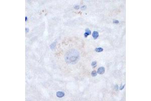 Image no. 2 for anti-Solute Carrier Family 17 (Sodium-Dependent Inorganic Phosphate Cotransporter), Member 8 (SLC17A8) (N-Term) antibody (ABIN571628)
