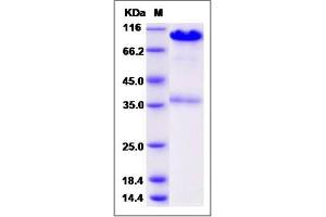 Image no. 1 for Calreticulin (CALR) (AA 1-413) protein (Fc Tag) (ABIN2005777)