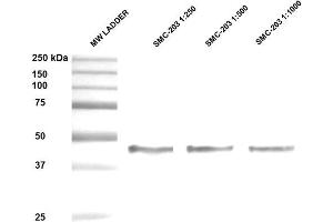 Image no. 2 for anti-serpin Peptidase Inhibitor, Clade H (Heat Shock Protein 47), Member 1, (Collagen Binding Protein 1) (SERPINH1) antibody (Biotin) (ABIN2484372)