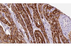 Image no. 1 for anti-Linker For Activation of T Cells (LAT) (pTyr200) antibody (ABIN6256669)