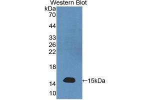 Image no. 1 for anti-Neurofilament, Light Polypeptide (NEFL) (AA 281-396) antibody (ABIN1176228)