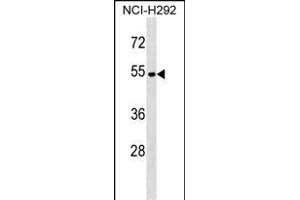 ATP6V1C2 Antibody (Center) (ABIN1538227 and ABIN2849357) western blot analysis in NCI- cell line lysates (35 μg/lane).