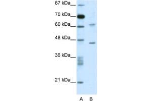 Image no. 1 for anti-TRM1 tRNA Methyltransferase 1-Like (TRMT1L) antibody (ABIN2460173)