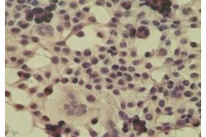 Image no. 3 for anti-Cylindromatosis (Turban Tumor Syndrome) (CYLD) (AA 32-45) antibody (ABIN200017)