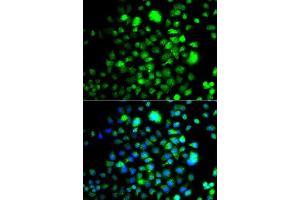 Image no. 4 for anti-Peroxisomal Biogenesis Factor 14 (PEX14) antibody (ABIN6145458)