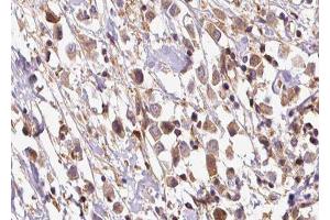 Image no. 2 for anti-Osteosarcoma Amplified 9, Endoplasmic Reticulum Lectin (OS9) (Internal Region) antibody (ABIN6263908)