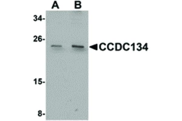 CCDC134 Antikörper  (N-Term)