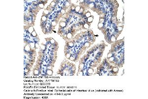 Image no. 1 for anti-Zinc Finger Protein 785 (ZNF785) (C-Term) antibody (ABIN2775096)