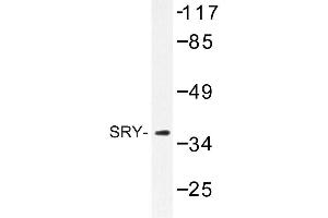 Image no. 1 for anti-Sex Determining Region Y (SRY) antibody (ABIN272215)