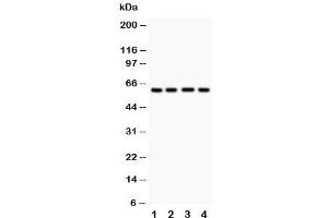 Image no. 2 for anti-Hexosaminidase A (HEXA) (C-Term) antibody (ABIN3031198)