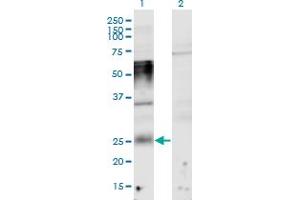 Western Blot analysis of TMEM123 expression in transfected 293T cell line by TMEM123 monoclonal antibody (M02), clone 1F4.