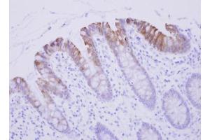 Image no. 2 for anti-Biglycan (BGN) (Center) antibody (ABIN2855480)