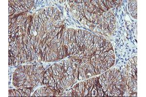 Image no. 2 for anti-V-Ral Simian Leukemia Viral Oncogene Homolog B (Ras Related, GTP Binding Protein) (Ralb) antibody (ABIN1500584)