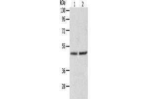 Image no. 1 for anti-Alanine Glyoxylate Aminotransferase (AGXT) antibody (ABIN2426537)