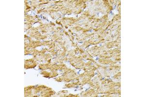 SLC25A5 antibody  (AA 150-250)