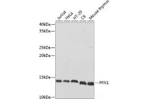 Western blot analysis of extracts of various cell lines using PFN1 Polyclonal Antibody at dilution of 1:500.