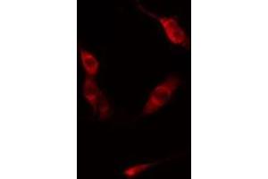 Image no. 2 for anti-Protein Kinase N1 (PKN1) antibody (ABIN6257420)