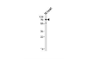 Image no. 6 for anti-Hyaluronan Synthase 2 (HAS2) (AA 138-166) antibody (ABIN651874)