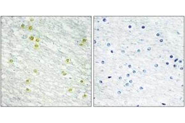 MED14 antibody  (AA 701-750)