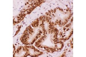 Image no. 4 for anti-Activating Transcription Factor 2 (ATF2) (AA 93-450) antibody (ABIN3043791)