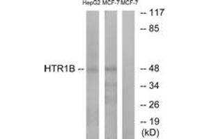 Image no. 1 for anti-Serotonin Receptor 1B (HTR1B) (AA 261-310) antibody (ABIN1535552)