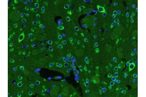 Image no. 4 for anti-Brain-Derived Neurotrophic Factor (BDNF) (AA 151-247) antibody (ABIN1387788)