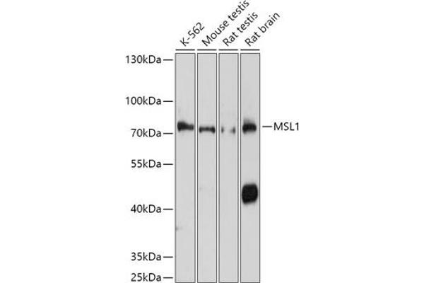 MSL1 抗体  (AA 210-300)