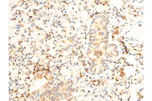 Image no. 1 for anti-Janus Kinase 1 (JAK1) (pTyr1034), (pTyr1035) antibody (ABIN6255762)
