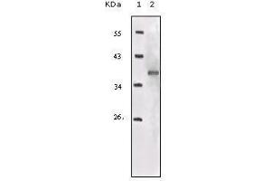 Image no. 3 for anti-Insulin-Like Growth Factor 1 Receptor (IGF1R) (AA 1101-1367) antibody (ABIN969207)